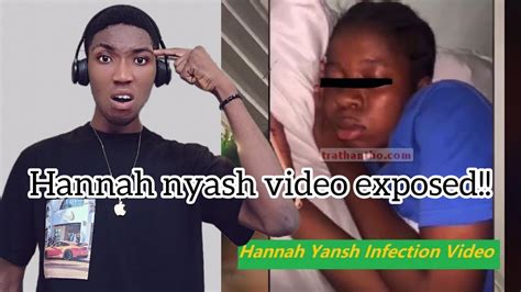 Hanna Yansh Viral Video